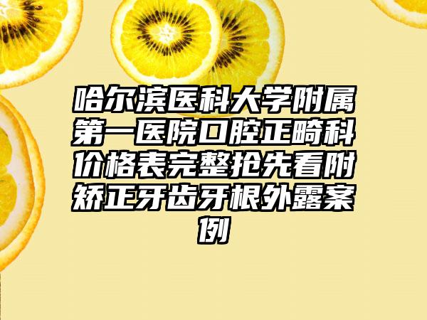 哈尔滨医科大学附属第一医院口腔正畸科价格表完整抢先看附矫正牙齿牙根外露案例