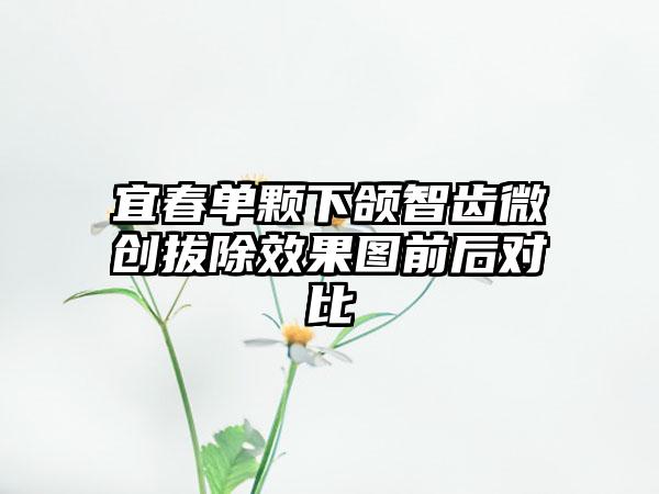 宜春单颗下颌智齿微创拔除效果图前后对比