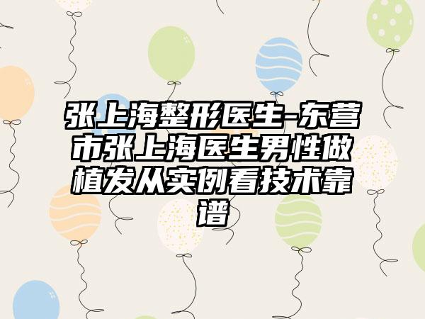 张上海整形医生-东营市张上海医生男性做植发从实例看技术靠谱