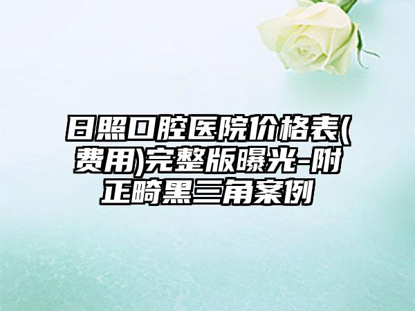 日照口腔医院价格表(费用)完整版曝光-附正畸黑三角案例