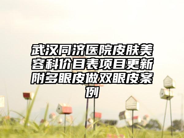 武汉同济医院皮肤美容科价目表项目更新附多眼皮做双眼皮案例