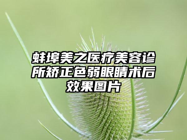 蚌埠美之医疗美容诊所矫正色弱眼睛术后效果图片