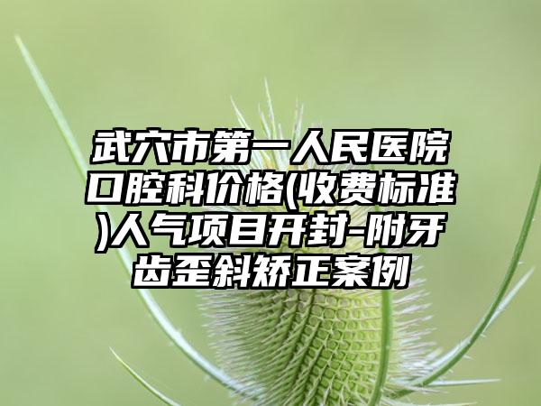 武穴市第一人民医院口腔科价格(收费标准)人气项目开封-附牙齿歪斜矫正案例