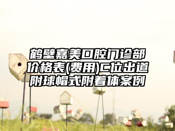 鹤壁嘉美口腔门诊部价格表(费用)C位出道附球帽式附着体案例